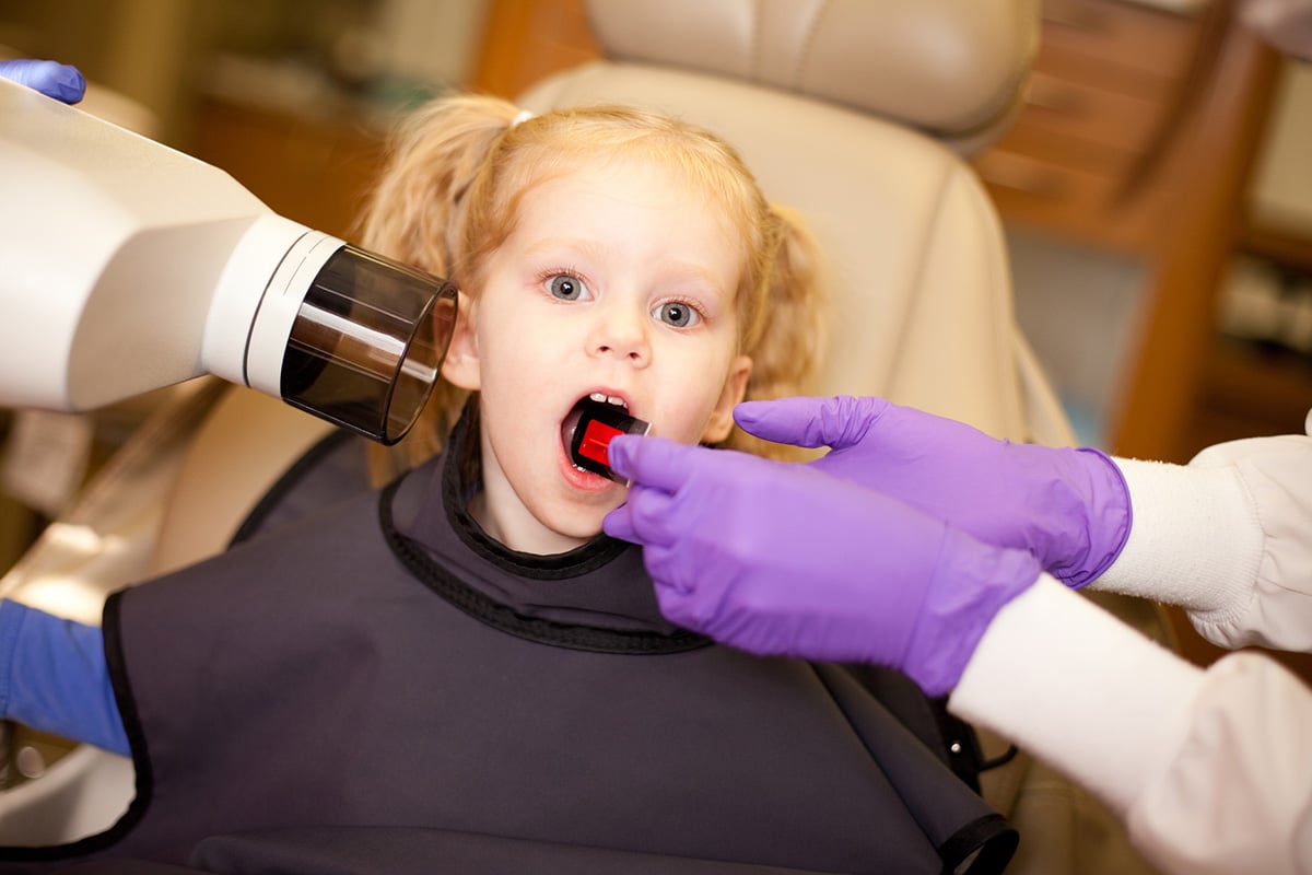 How Often Should Kids Get Dental XRays?