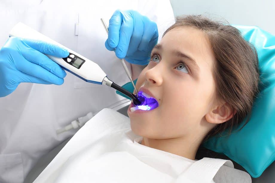 Sealants for Kids: Do They Really Prevent Cavities?